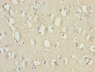 Polyclonal Rabbit anti-Human RABGEF1 Antibody (aa1-491)