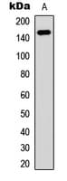 PNPLA6 / NTE Antibody (N-Terminus)