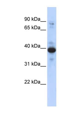 RNF34 Antibody (aa143-192)