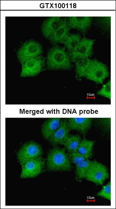 IHC-plus™ GAPDH Antibody