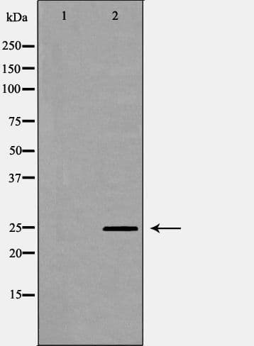 Polyclonal Rabbit anti-Human OPRS1 / SIGMAR1 Antibody (IHC, WB)