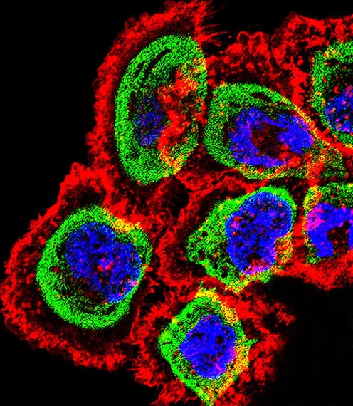 RCAN1 / DSCR1 Antibody (aa41-68)