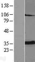 ANT2 / SLC25A5 Protein (Over-Expression Lysate Myc-DDK (Flag))