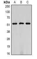 PathPlus™ Vimentin Antibody