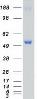 Human CAMK2D / CaMKII Delta Protein (Recombinant Myc-DDK (Flag))
