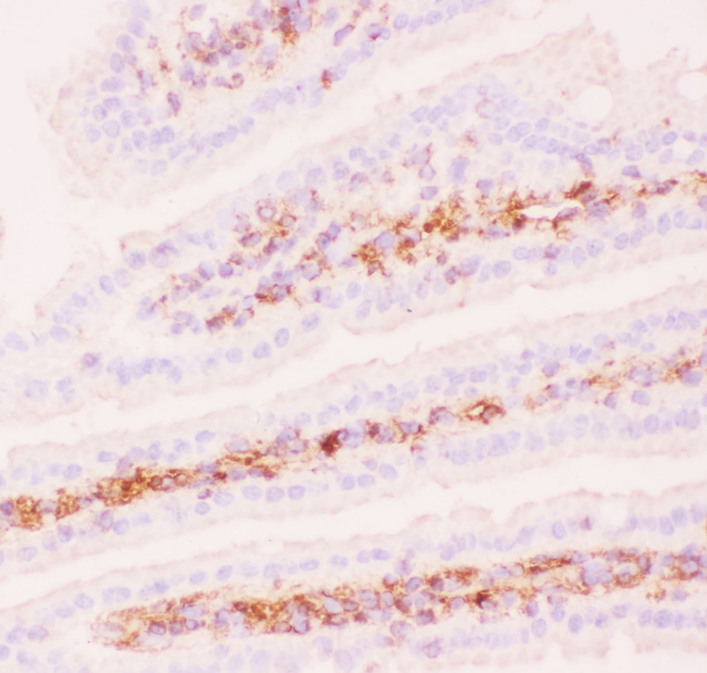 ABCB1 / MDR1 / P Glycoprotein Antibody (aa621-650)