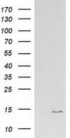 IHC-plus™ Monoclonal Mouse anti-Human ATP6V1F Antibody (clone 5F10, IHC, IF, WB)
