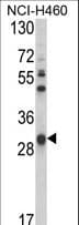 GSTO1 Antibody (aa126-155)