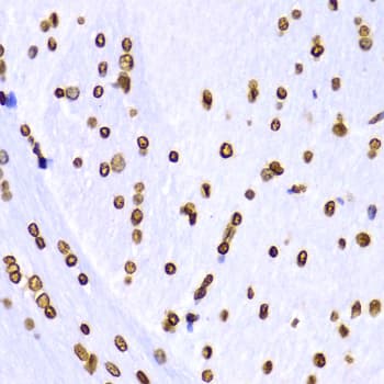 Histone H3 Antibody (Tri-Methyl-Lys9)