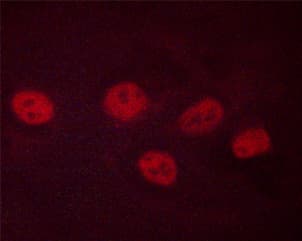 CREB1 / CREB Antibody (phospho-Ser142)