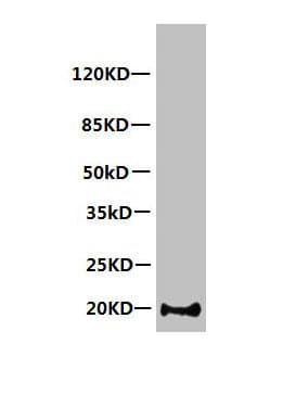 Monoclonal Mouse anti-Human MB / Myoglobin Antibody (clone 7A3D2, IHC, WB)