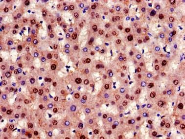 Polyclonal Rabbit anti-Human GCGR / Glucagon Receptor Antibody (aa26-136, IHC, IF, WB)