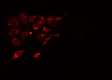 Polyclonal Rabbit anti-Human ADORA2A/Adenosine A2A Receptor Antibody (IHC, IF, WB)