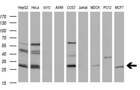 Monoclonal Mouse anti-Human BCL2 / Bcl-2 Antibody (clone OTI7H9, IHC, WB)