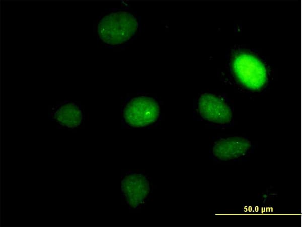 TBX2 Antibody (clone 7G5)