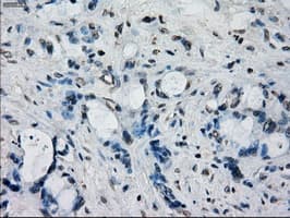 Monoclonal Mouse anti-Human FRK Antibody (clone OTI6D2, IHC, IF, WB)