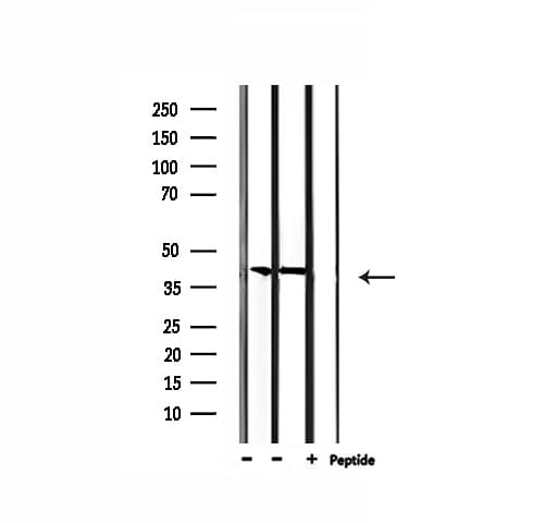 Polyclonal Rabbit anti-Human CBX6 Antibody (IF, WB)