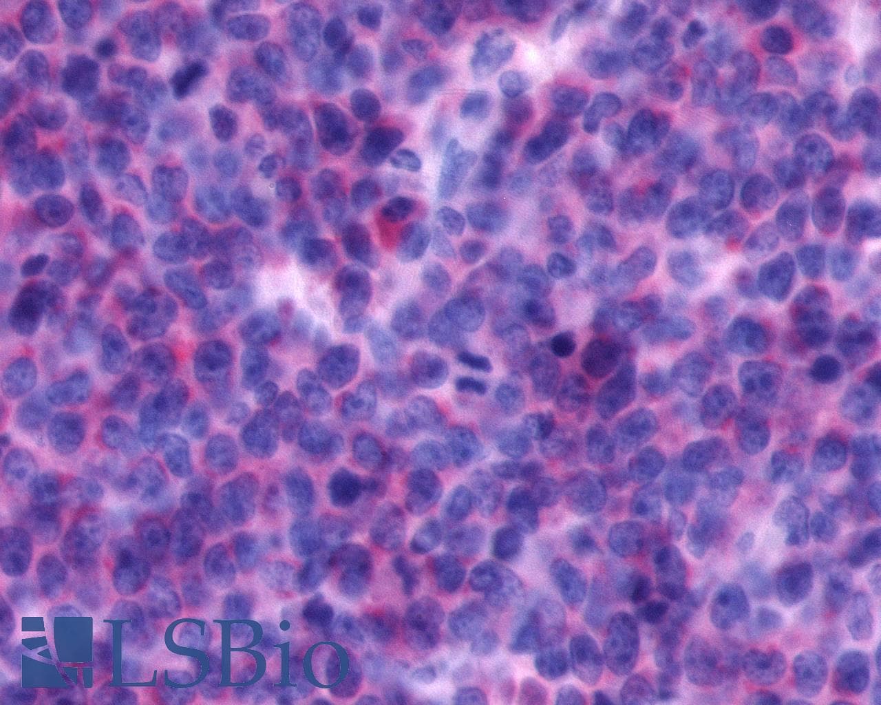 PathPlus™ CXCR4 Antibody (Cytoplasmic Domain)