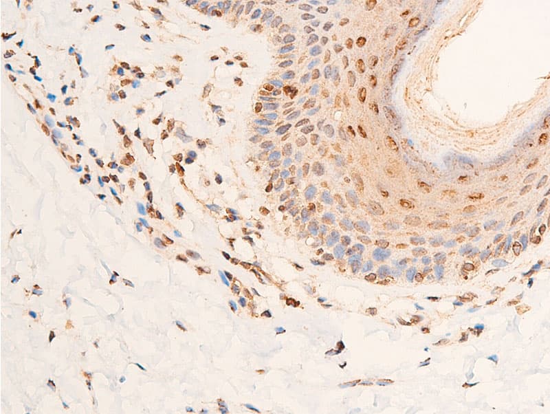 Polyclonal Rabbit anti-Human CHEK2 / CHK2 Antibody (phospho-Thr383, IHC, IF, WB)