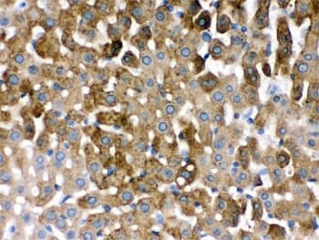 SULT2A1 / Sulfotransferase 2A1 Antibody