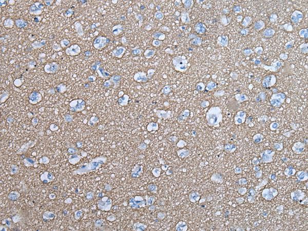 Polyclonal Rabbit anti-Human SNCB / Beta-Synuclein Antibody (IHC, WB)