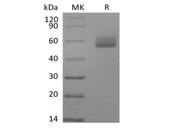 Human GPIHBP1 Protein (Recombinant Fc, C-terminus)