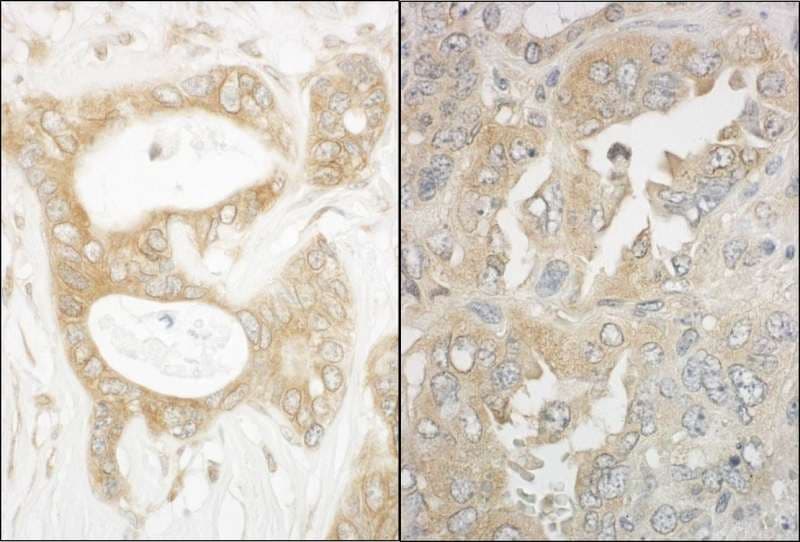 MAPRE1 / EB1 Antibody (aa245-268)