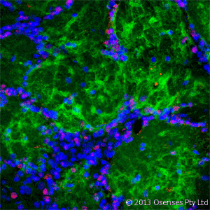 NGFR / CD271 / TNR16 Antibody (clone MC192)
