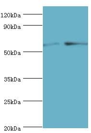 PPP3CC / CALNA3 Antibody (aa373-512)