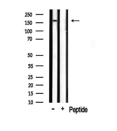 Polyclonal Rabbit anti-Human TOP2A / Topoisomerase II Alpha Antibody (IHC, IF, WB)