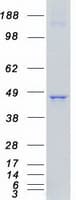 Human ROR1 Protein (Recombinant Myc-DDK (Flag))