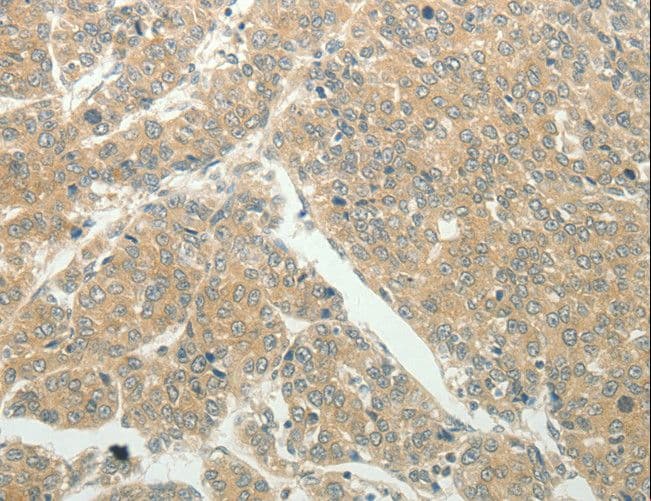 SLC8A3 / NCX3 Antibody