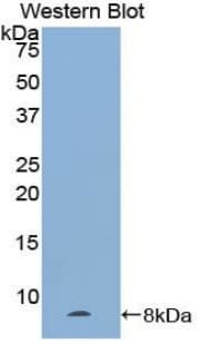 NPPA / ANP Antibody (aa25-152)
