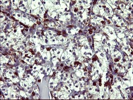 TP73 / p73 Antibody (aa167-409, clone OTI3C5)