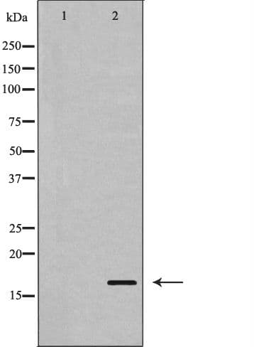 STMN1 / Stathmin / LAG Antibody