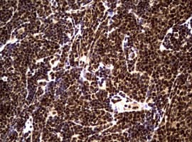 Monoclonal Mouse anti-Human NBN / Nibrin Antibody (clone OTI8E7, IHC, WB)