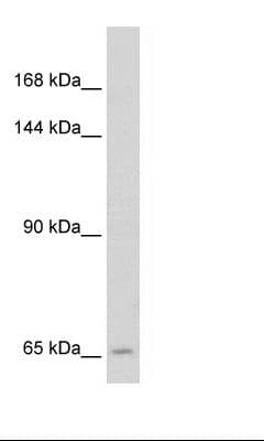 SLC19A1 Antibody (N-Terminus)