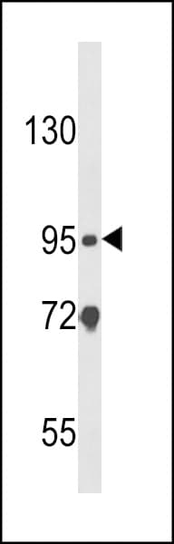 IHC-plus™ Polyclonal Rabbit anti-Human NOD1 Antibody (aa923-951, IHC, WB)