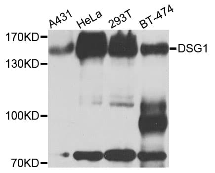 IHC-plus™ Polyclonal Rabbit anti-Human DSG1 / Desmoglein 1 Antibody (IHC, WB)