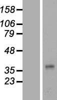 LPPR1 Protein (Over-Expression Lysate Myc-DDK (Flag))