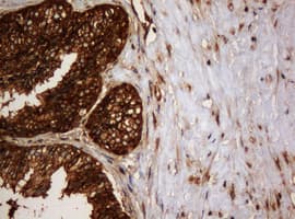 PAI-RBP1 / SERBP1 Antibody (aa1-262, clone OTI1E7)