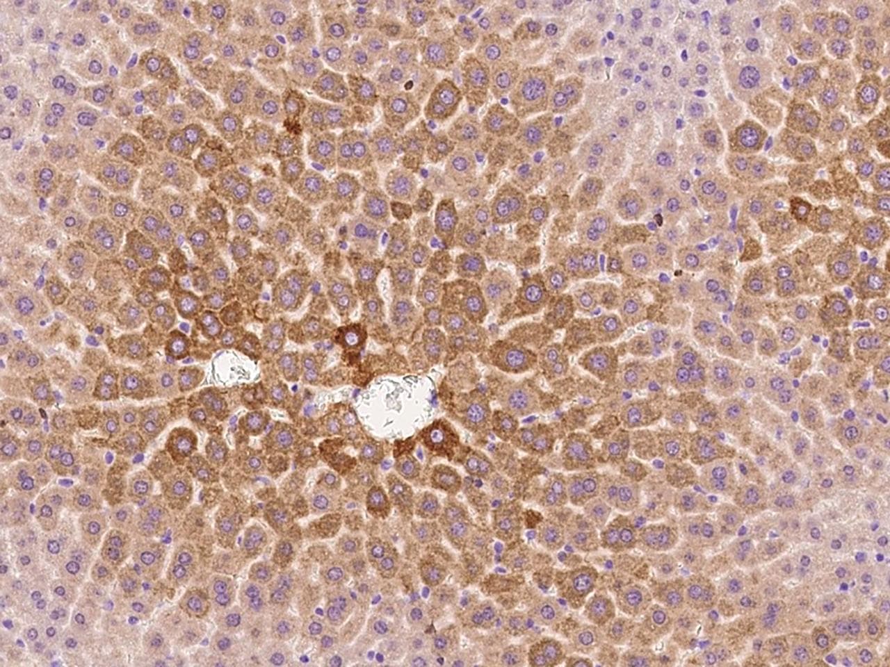 CTSE / Cathepsin E Antibody
