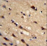Polyclonal Rabbit anti-Human PPIC / Cyclophilin C Antibody (aa61-89, IHC, WB)