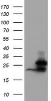 UBE2E3 Antibody (clone OTI2C7)