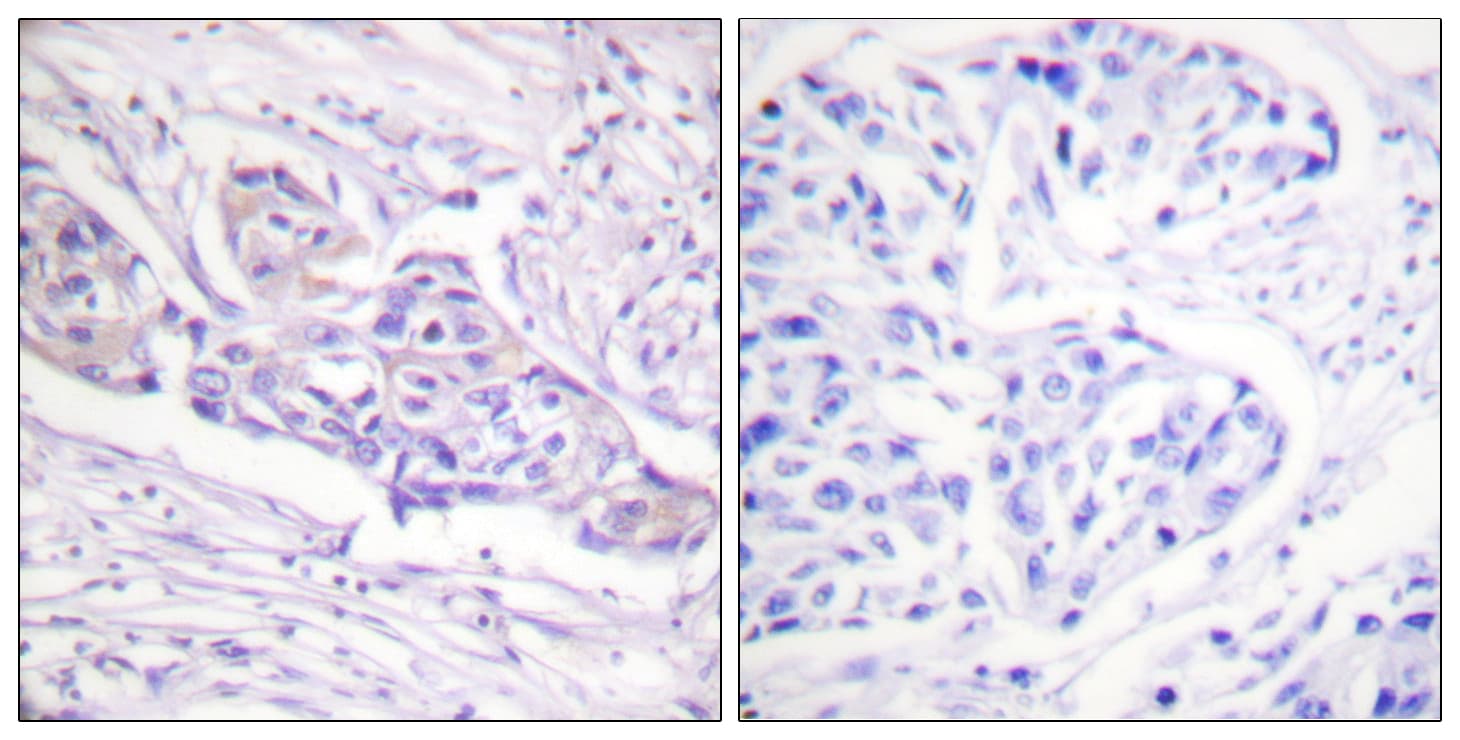 FOXO1 / FKHR Antibody (phospho-Ser329)