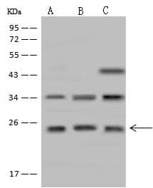 Polyclonal Rabbit anti-Human CYB561D1 Antibody (WB)