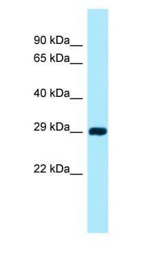 CSAD / CSD Antibody (aa48-97)
