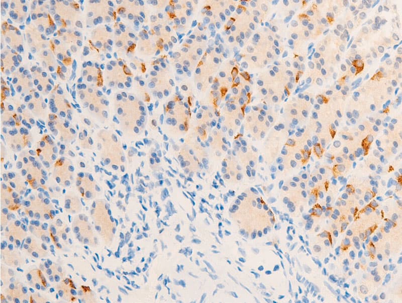 ERBB2 / HER2 Antibody (phospho-Tyr877)