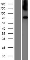 Human GALC / Galactocerebrosidase Protein (Over-Expression Lysate Myc-DDK (Flag))
