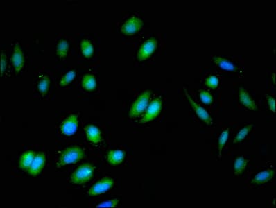 Polyclonal Rabbit anti-Human BIN3 Antibody (IF)